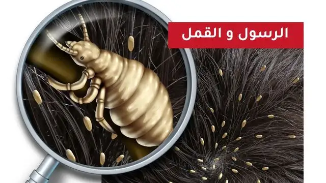 الرسول والقمل